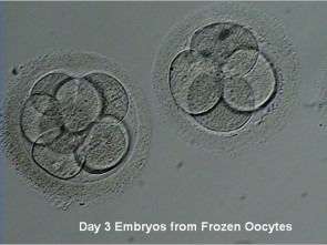 Oocytes